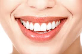 Men răng sau khi tẩy trắng duy trì được lâu không?