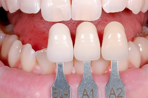 Những phương pháp điều trị bệnh răng miệng