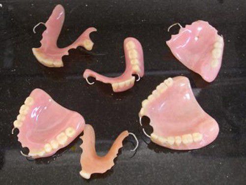 Những phương pháp trồng răng giả hiện nay