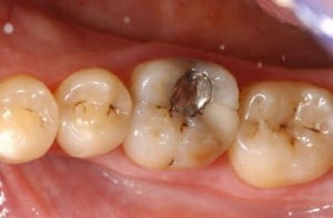 Những vấn đề răng miệng cần được điều trị
