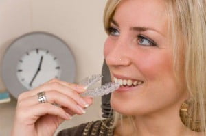 Tuổi tác có ảnh hưởng đến kết quả niềng răng ?