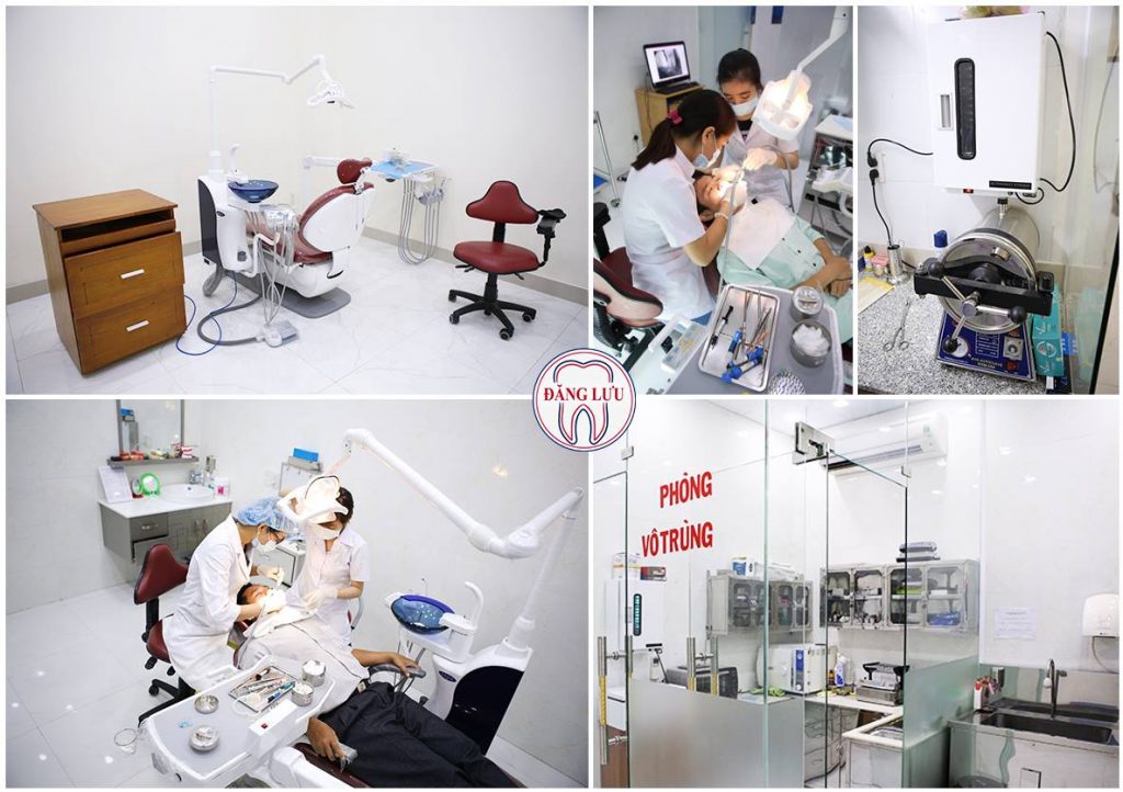 Niềng răng tháo lắp giá bao nhiêu