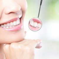 cạo vôi răng có tác dụng gì