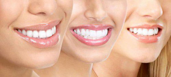 quy trình tẩy trắng răng bằng laser như thế nào