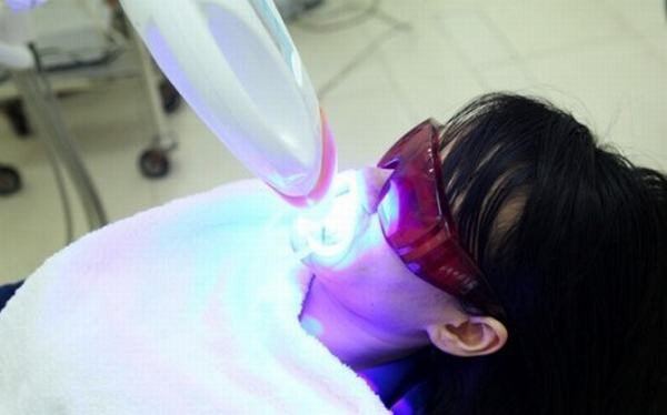 tẩy trắng răng bằng laser whitening bao nhiêu tiền