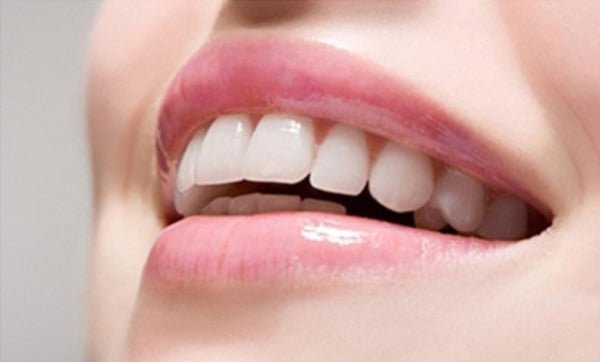 tẩy trắng răng vĩnh viễn có được không