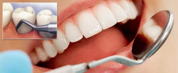 bị chảy máu chân răng nên uống thuốc gì