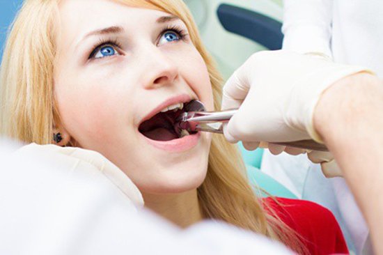 làm gì khi răng khôn hàm dưới mọc lệch