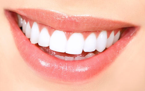 Bọc răng sứ cho răng khấp khểnh giúp răng đều đặn 1