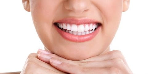 Bọc răng sứ được bao lâu thì thay răng sứ mới? 2