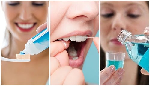 Bọc răng sứ được bao lâu thì thay răng sứ mới? 4