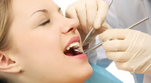 Bọc sứ răng cửa cho hàm răng trắng khỏe linh hoạt 3