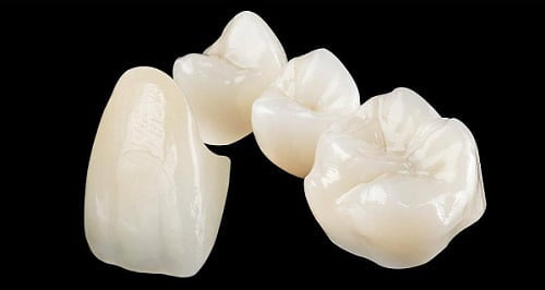 Các loại răng sứ được khách hàng yêu thích nhất 5 Các loại răng sứ được khách hàng yêu thích nhất 5