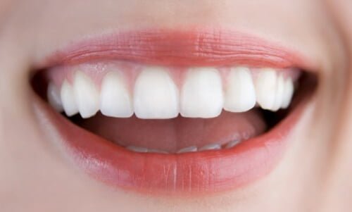 Làm răng giả - Phương pháp phục hình răng hiện đại 1