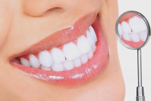 Làm răng sứ cho hàm răng chắc khỏe nụ cười thẩm mỹ 1