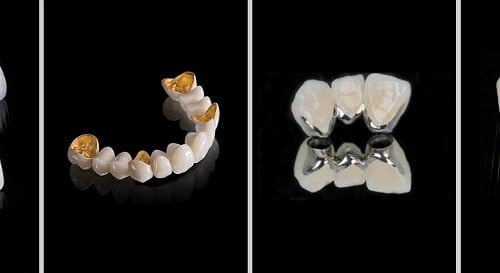 Răng sứ mang nhiều ưu điểm về thẩm mỹ và chất lượng 3 Răng sứ mang nhiều ưu điểm về thẩm mỹ và chất lượng 3