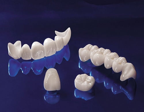 Răng sứ mang nhiều ưu điểm về thẩm mỹ và chất lượng 4