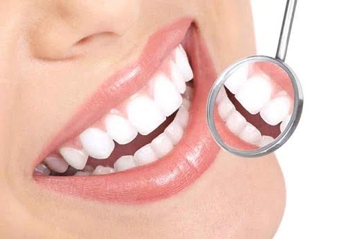 Răng sứ bị mẻ - Tìm ra nguyên nhân để phòng tránh 3 Răng sứ bị mẻ - Tìm ra nguyên nhân để phòng tránh 3