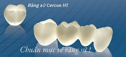 Răng sứ cercon giá bao nhiêu? Các yếu tố nào chi phối? 3
