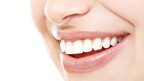 Răng sứ veneer là gì? Ưu điểm vượt trội của loại răng này 2
