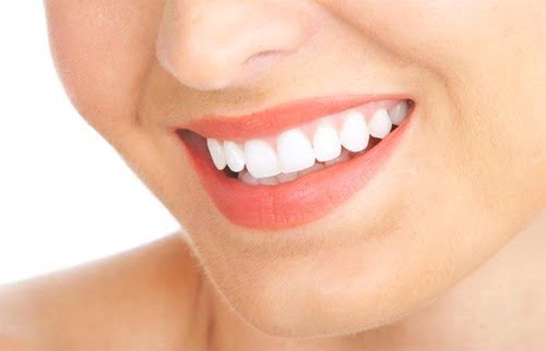Răng toàn sứ - Giải thích vì sao bạn nên lựa chọn loại răng này 2