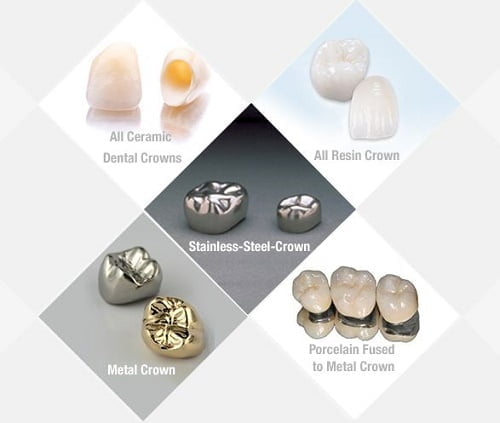 1 bộ răng sứ bao nhiêu tiền là đều đẹp và bền chắc? 3 1 bộ răng sứ bao nhiêu tiền là đều đẹp và bền chắc? 3