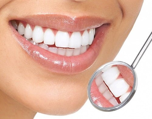 Răng sứ bị vàng - 3 điều bạn nhất định phải biết 1 Răng sứ bị vàng - 3 điều bạn nhất định phải biết 1