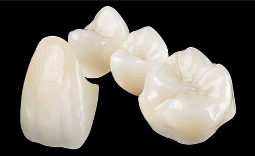 Răng sứ ceramill thuộc nhóm nào? Có những ưu điểm gì? 1