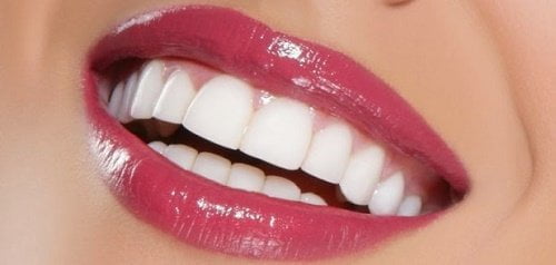 Răng sứ ceramill thuộc nhóm nào? Có những ưu điểm gì? 2