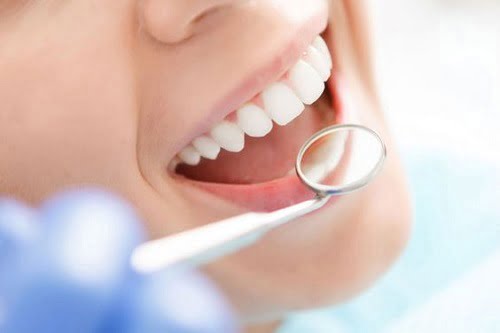 Răng sứ có mài được không khi bị dài hơn răng thật? 3