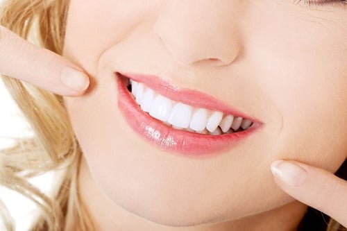 Niềng răng phải đeo hàm duy trì bao lâu? Vì sao phải đeo? 3 Niềng răng phải đeo hàm duy trì bao lâu? Vì sao phải đeo? 3