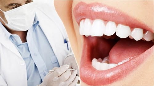 Bọc răng sứ kim loại có bền không? Cách chăm sóc 4