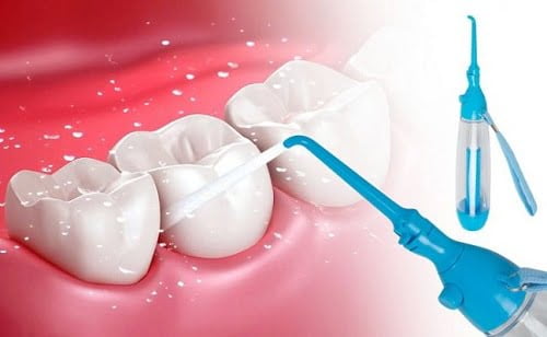 Cạo vôi răng siêu âm có an toàn không? 3