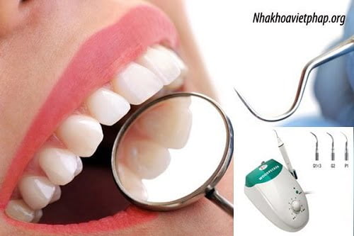 Lấy cao răng có ảnh hưởng không? Tìm hiểu ngay 3 Lấy cao răng có ảnh hưởng không? Tìm hiểu ngay 3