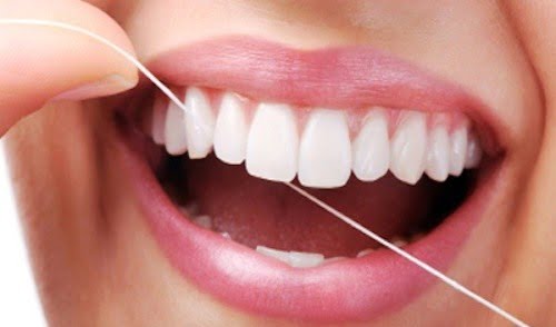 Bọc răng sứ veneer có tốt không? Lưu ý khi thực hiện 4