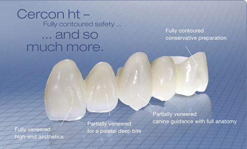Giá răng sứ cercon áp dụng tại trung tâm nha khoa chuyên nghiệp 1