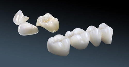 Giá răng sứ cercon áp dụng tại trung tâm nha khoa chuyên nghiệp 3