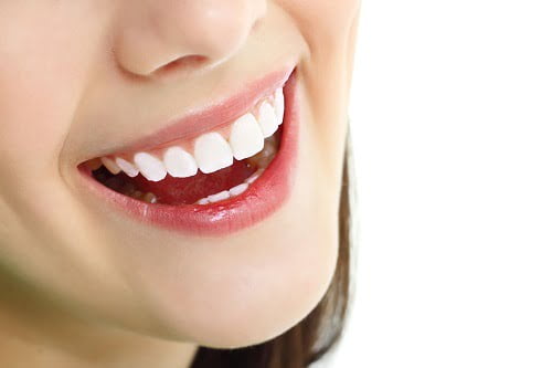Có nên trồng răng sứ không? Giải đáp thắc mắc 1 Có nên trồng răng sứ không? Giải đáp thắc mắc 1