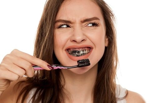 Tẩy trắng răng bằng than hoạt tính - Một cách làm phổ biến hiện nay 2