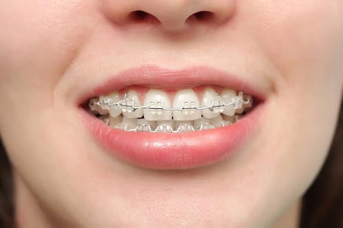 Cách chăm sóc răng miệng hiệu quả *