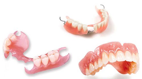 Trồng răng giả mất bao lâu với từng phương pháp? 2 Trồng răng giả mất bao lâu với từng phương pháp? 2