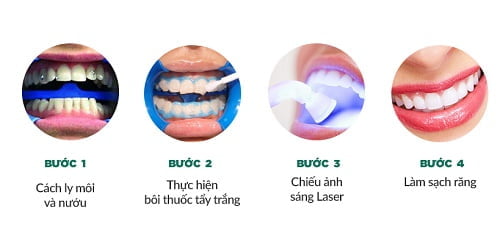 Công nghệ tẩy trắng răng brite smile 2 Công nghệ tẩy trắng răng brite smile 2