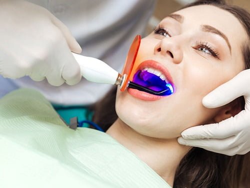 Tẩy trắng răng plasma có hại không? Tham khảo từ nha khoa 2