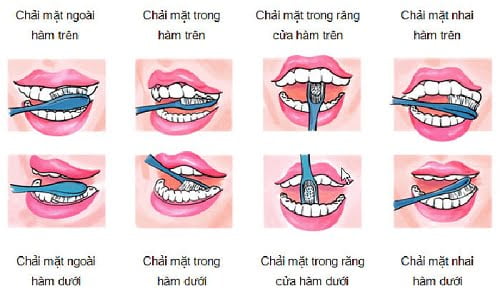 Trồng răng kiêng ăn gì? Bạn nên tham khảo 3 Trồng răng kiêng ăn gì? Bạn nên tham khảo 3
