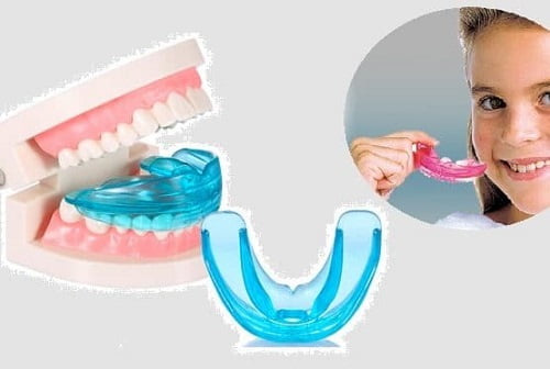 Dụng cụ niềng răng tại nhà 3 giai đoạn cho bạn 2