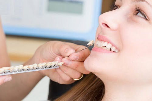 Trồng răng khểnh có đau không? Phương pháp thẩm mỹ 2