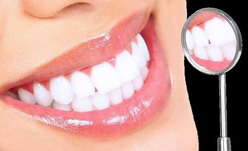 Trồng răng nên ăn gì để đảm bảo sức khỏe răng miệng? 1