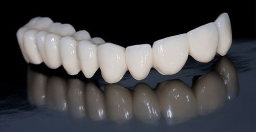 Trồng răng sứ có bền không? Tìm hiểu về răng sứ 2