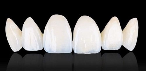 Trồng răng sứ có bền không? Tìm hiểu về răng sứ 3